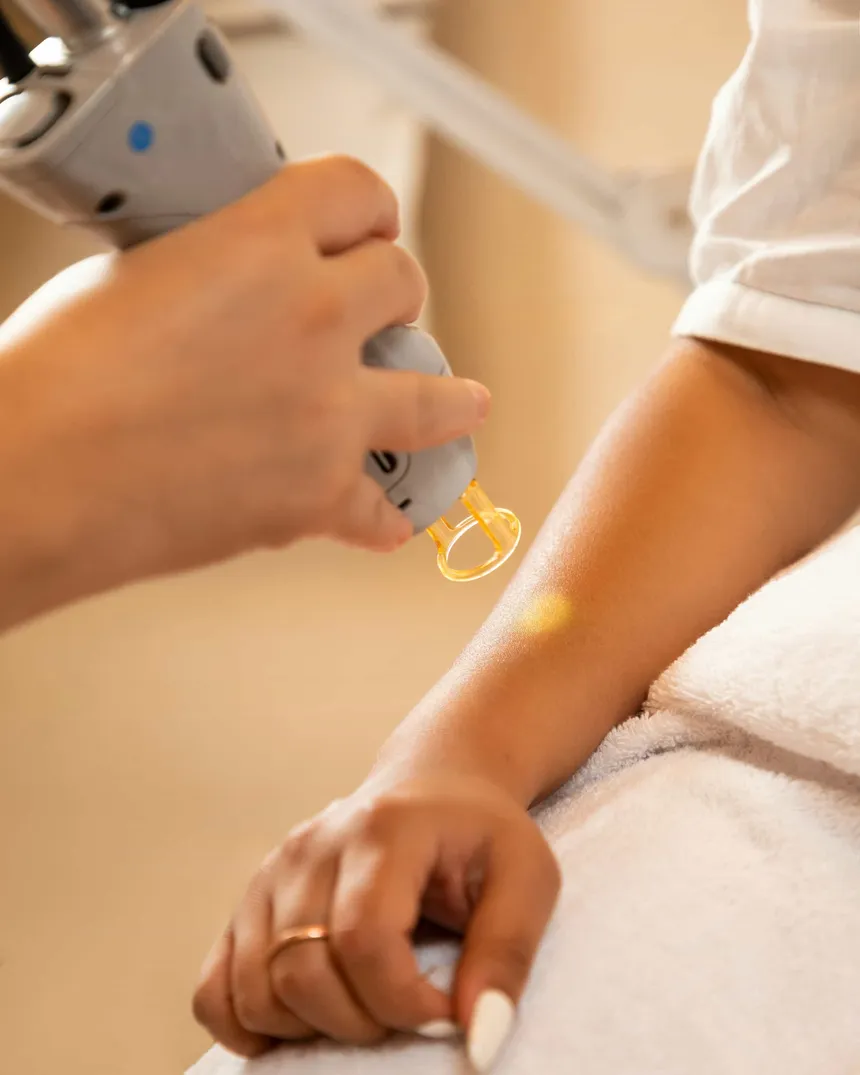 Eine Frau bei der Behandlung zur Haarentfernung mit einem Laser